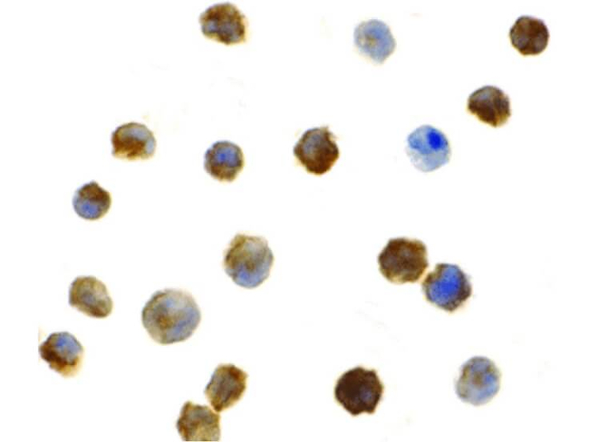 IRAK2 Antibody in Immunocytochemistry (ICC/IF)