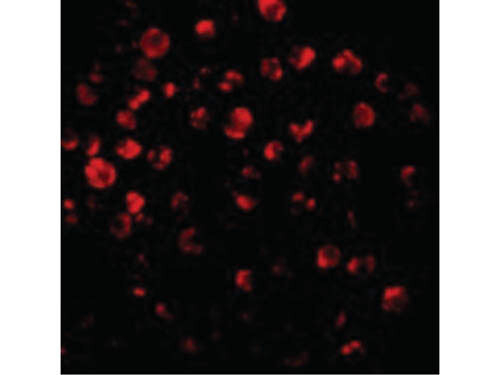 IRAK2 Antibody in Immunocytochemistry (ICC/IF)