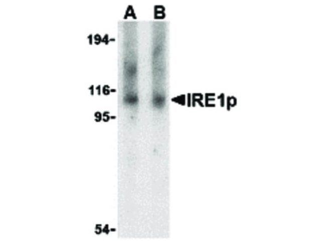 IRE1p Antibody in Western Blot (WB)