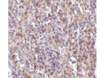 ORAI1 Antibody in Immunohistochemistry (Paraffin) (IHC (P))