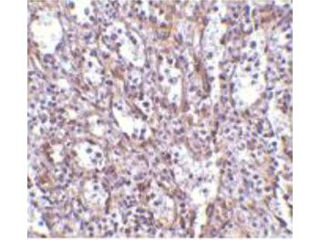 STIM1 Antibody in Immunohistochemistry (Paraffin) (IHC (P))