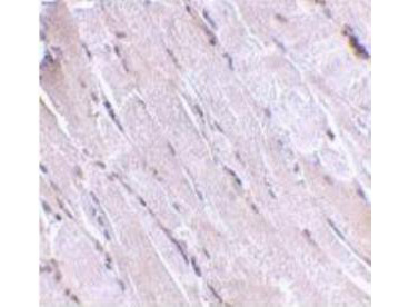 Wnt10B Antibody in Immunohistochemistry (Paraffin) (IHC (P))