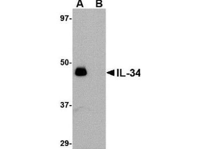 IL-34 Antibody in Western Blot (WB)