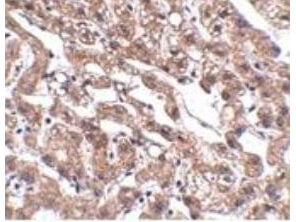 MACC1 Antibody in Immunohistochemistry (Paraffin) (IHC (P))