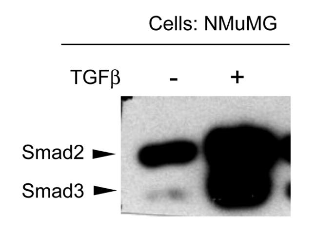 Phospho-SMAD3 (Thr179) Antibody in Western Blot (WB)