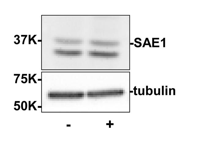 SAE1 Antibody in Western Blot (WB)