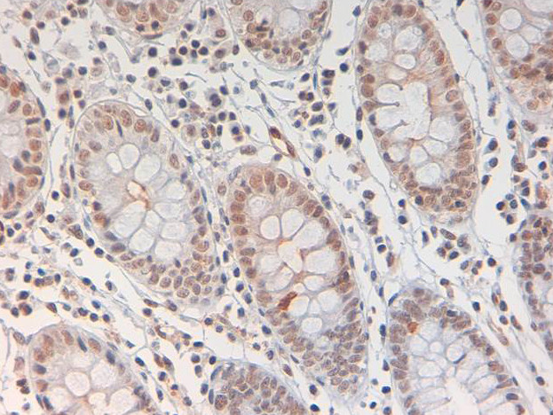 Phospho-STAT3 (Tyr705) Antibody in Immunohistochemistry (Paraffin) (IHC (P))