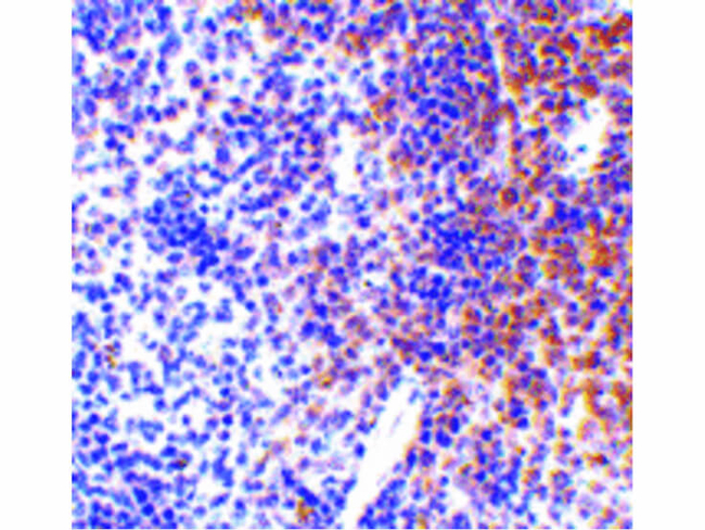 IRF7 Antibody in Immunohistochemistry (Paraffin) (IHC (P))