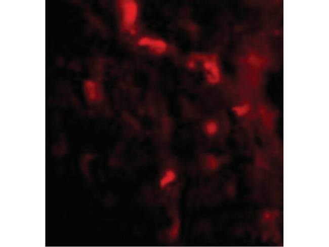 IRGM Antibody in Immunocytochemistry (ICC/IF)