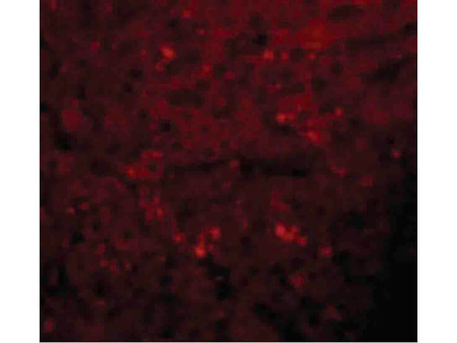 JMJD1A Antibody in Immunocytochemistry (ICC/IF)