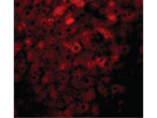 JMJD1B Antibody in Immunocytochemistry (ICC/IF)