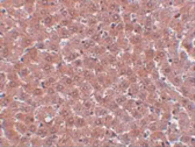 JMJD2A Antibody in Immunohistochemistry (Paraffin) (IHC (P))