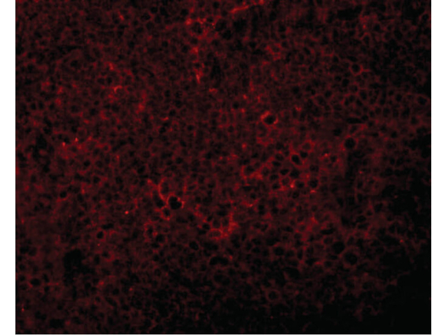 JMJD4 Antibody in Immunocytochemistry (ICC/IF)