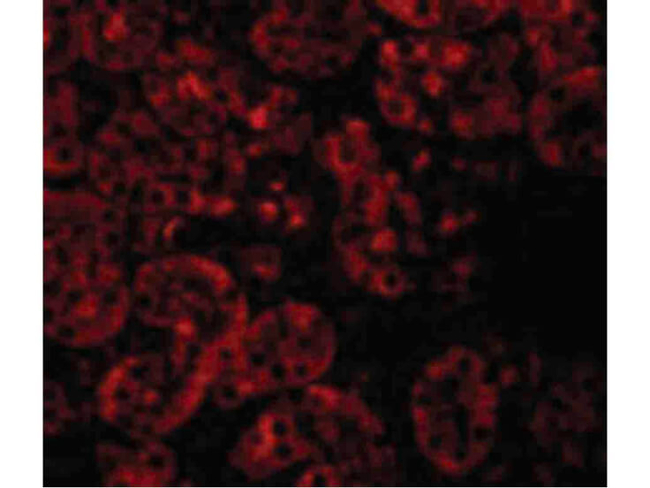 JMJD8 Antibody in Immunocytochemistry (ICC/IF)