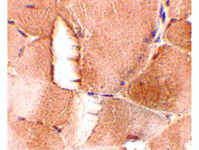 JPH1 Antibody in Immunohistochemistry (Paraffin) (IHC (P))