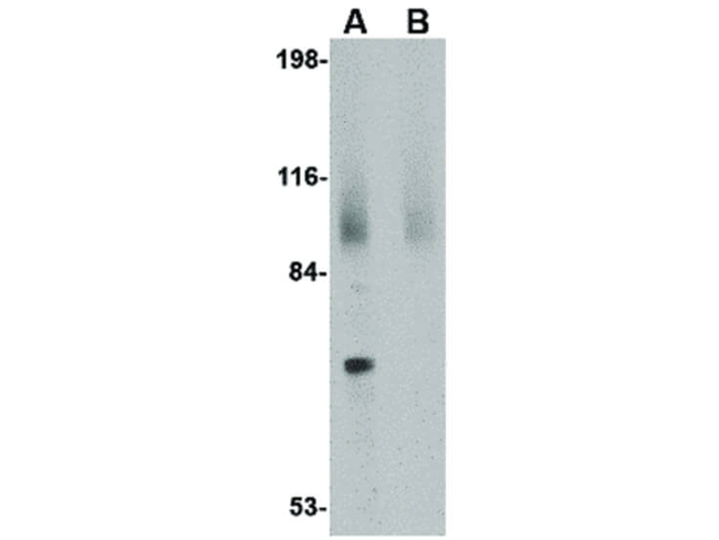 JPH2 Antibody in Western Blot (WB)