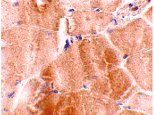 JPH2 Antibody in Immunohistochemistry (Paraffin) (IHC (P))