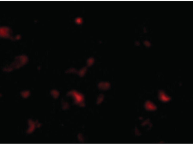 JPH3 Antibody in Immunocytochemistry (ICC/IF)