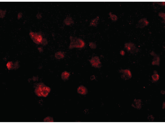 JPH3 Antibody in Immunocytochemistry (ICC/IF)