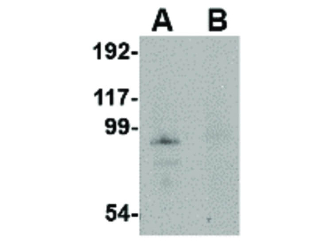 JPH4 Antibody in Western Blot (WB)