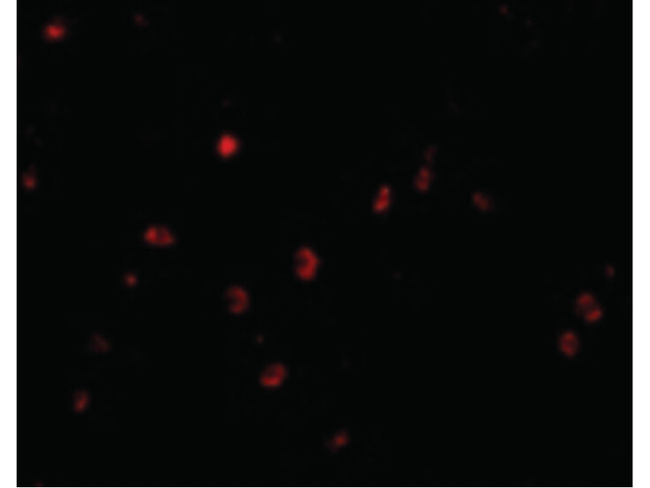 KAI1 Antibody in Immunocytochemistry (ICC/IF)