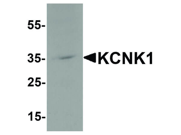 KCNK1 Antibody in Western Blot (WB)