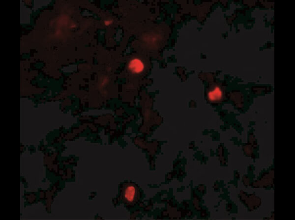 KEAP1 Antibody in Immunocytochemistry (ICC/IF)