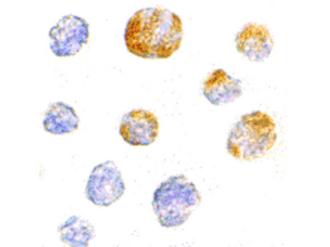 KIF5 Antibody in Immunocytochemistry (ICC/IF)