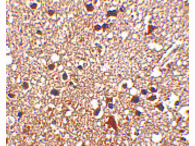 KIF5 Antibody in Immunocytochemistry (ICC/IF)
