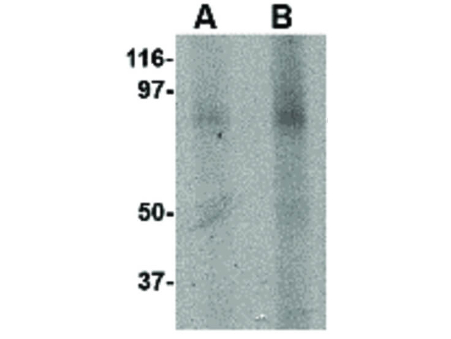 KINDLIN3 Antibody in Western Blot (WB)