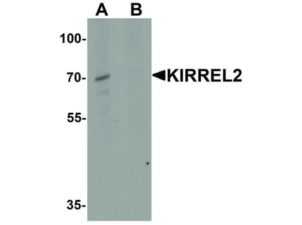 KIRREL2 Antibody in Western Blot (WB)