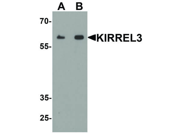 KIRREL3 Antibody in Western Blot (WB)