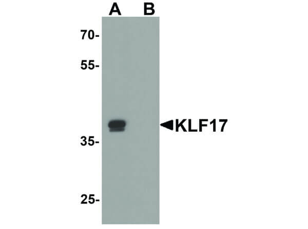KLF17 Antibody in Western Blot (WB)