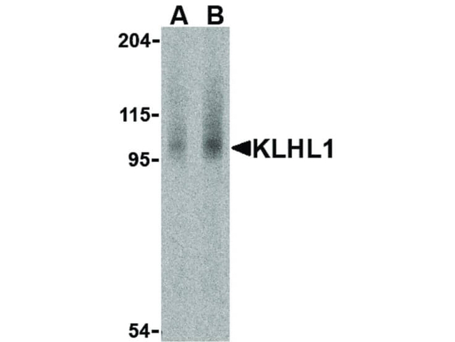 KLHL1 Antibody in Western Blot (WB)