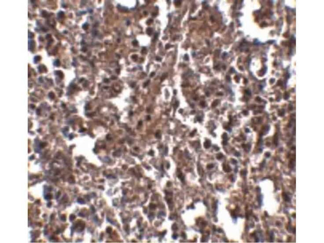KLRA2 Antibody in Immunohistochemistry (Paraffin) (IHC (P))