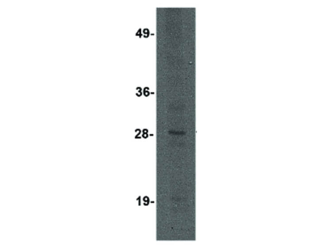 KLRA3 Antibody in Western Blot (WB)