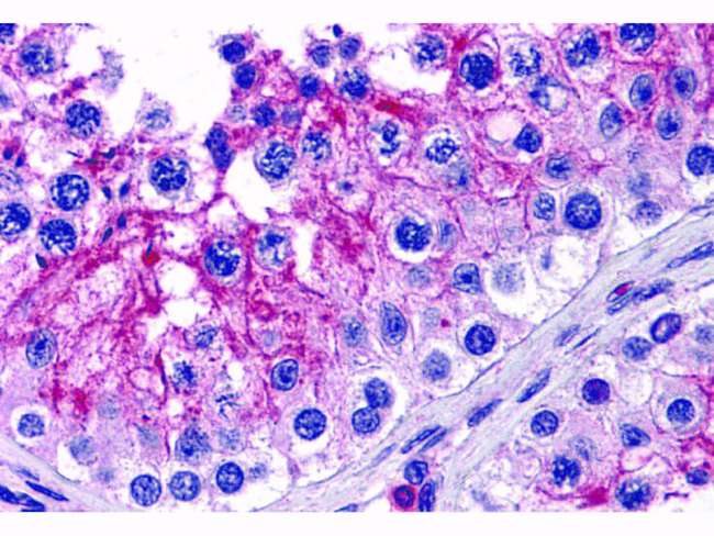 KPNA5 Antibody in Immunohistochemistry (Paraffin) (IHC (P))