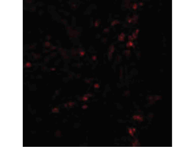 LAMP1 Antibody in Immunocytochemistry (ICC/IF)