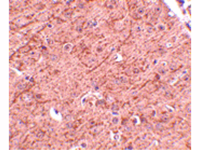 LASS5 Antibody in Immunohistochemistry (Paraffin) (IHC (P))