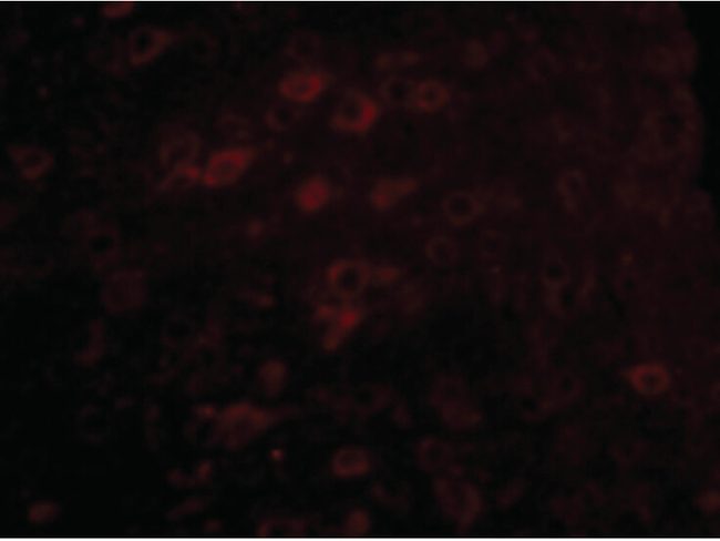 LASS6 Antibody in Immunocytochemistry (ICC/IF)