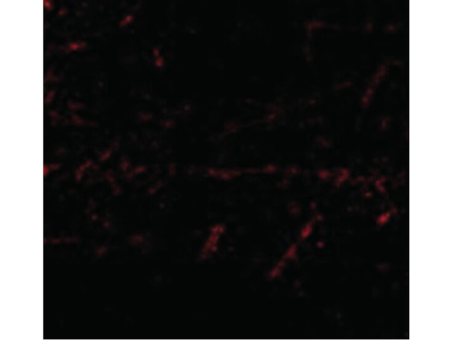 LGI1 Antibody in Immunocytochemistry (ICC/IF)