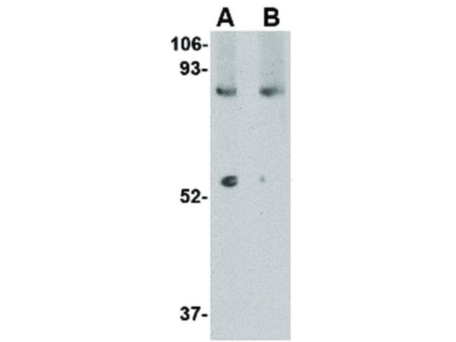 LGI1 Antibody in Western Blot (WB)