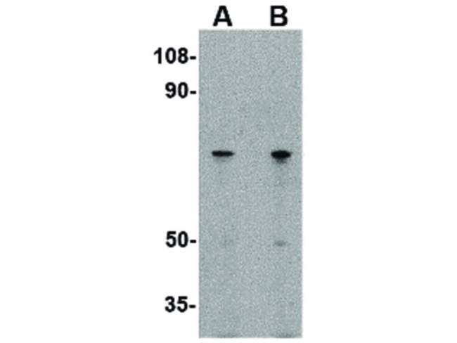 LGI2 Antibody in Western Blot (WB)