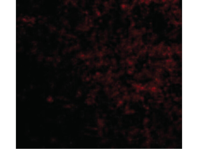 LGI2 Antibody in Immunocytochemistry (ICC/IF)