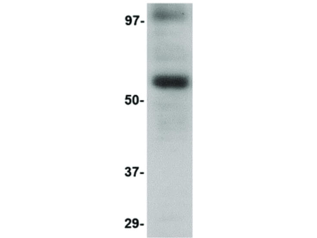 LGI3 Antibody in Western Blot (WB)