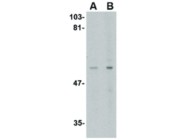LGI4 Antibody in Western Blot (WB)