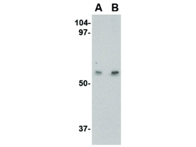 LGI4 Antibody in Western Blot (WB)
