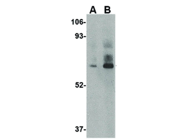 LGP2 Antibody in Western Blot (WB)