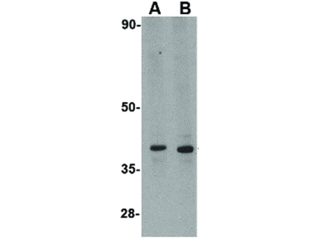 LGP2 Antibody in Western Blot (WB)