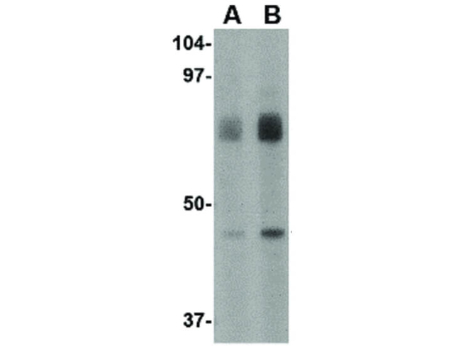 LGP2 Antibody in Western Blot (WB)